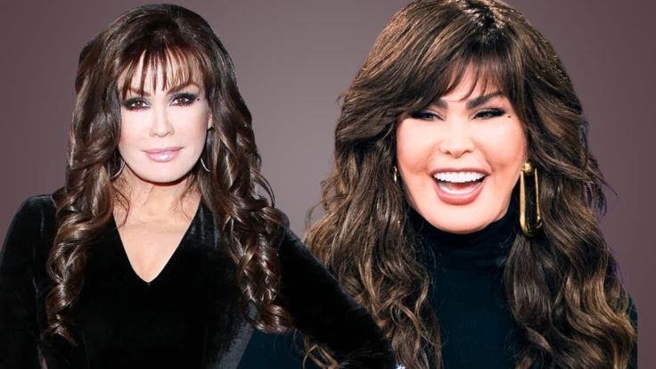 marie osmond cosmetic surgery